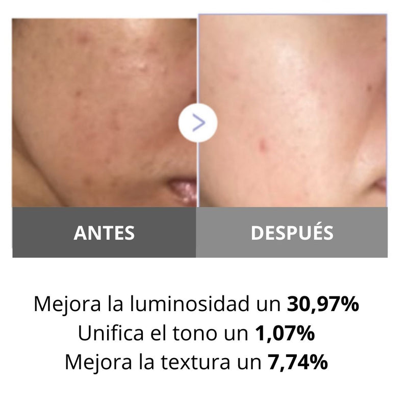 Dispositivo Medicube AGE-R Booster Pro Mini White