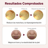 Set de ampollas Centellian24 Expert Madeca Mela Capture Ampoule Max 15ml x 3ud